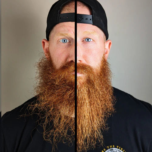 BARZDOS ALIEJUS NAKČIAI - THE BEARD STRUGGLE